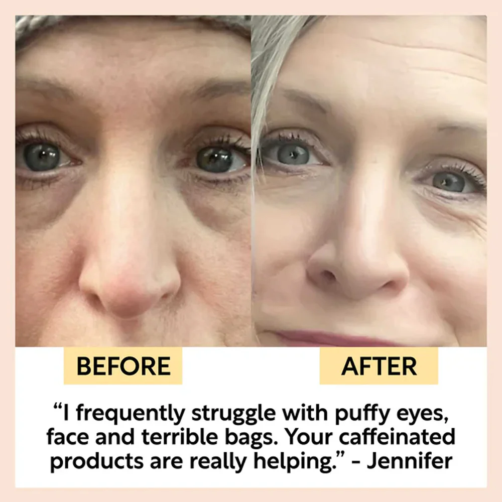 UpCircle Eye Cream - Image 6