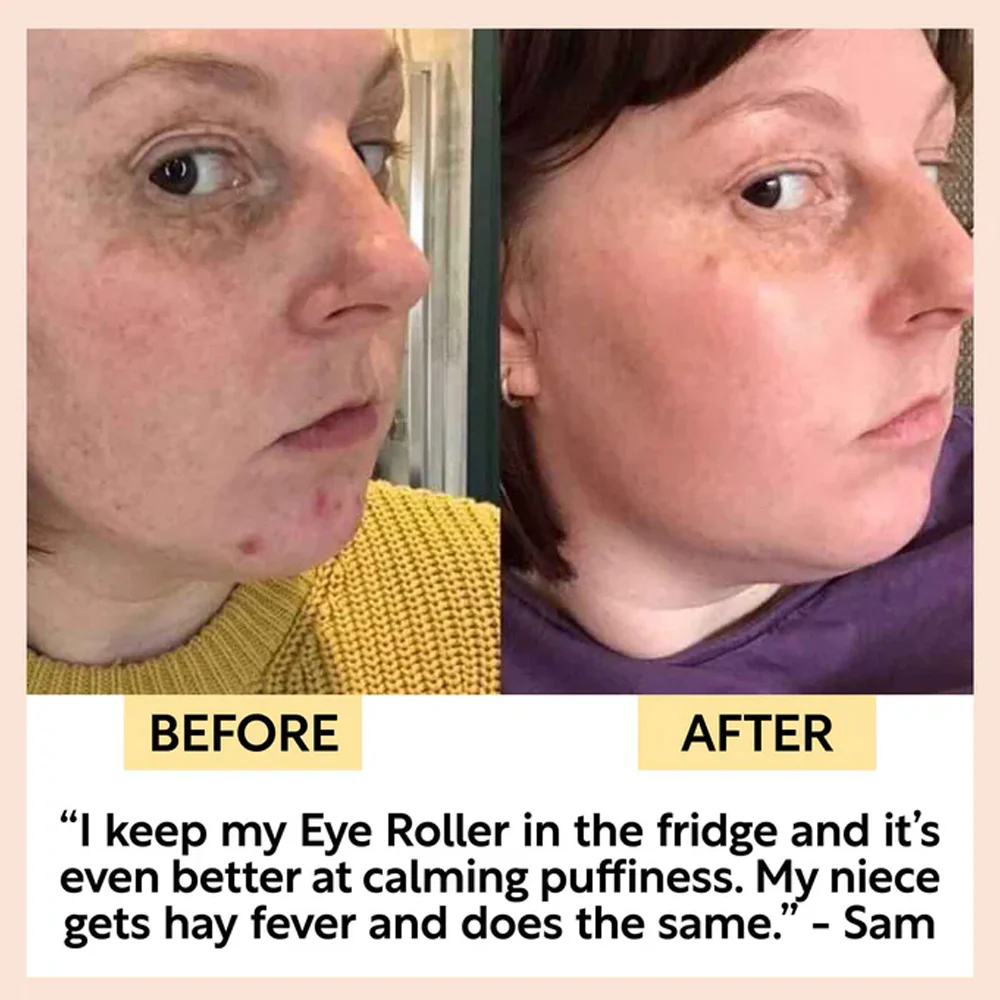 UpCircle Eye Roller - Image 5