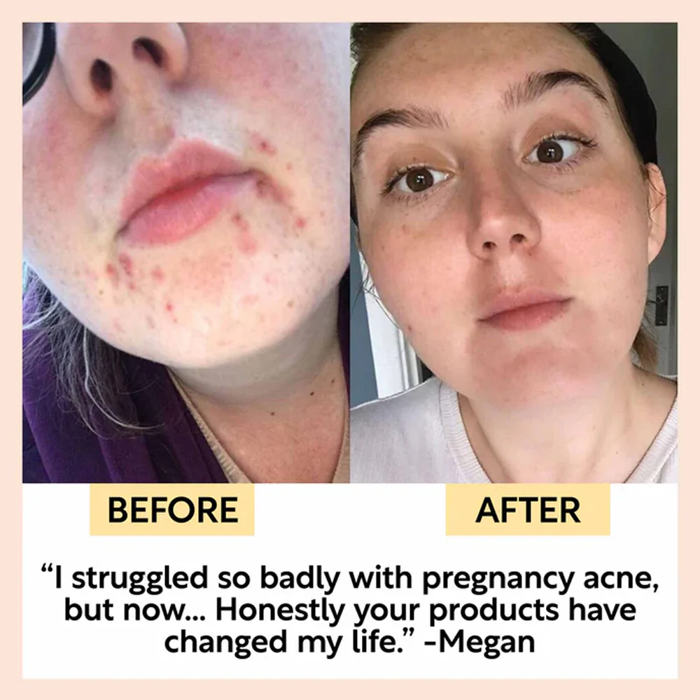 UpCircle Face Moisturiser With Vitamin E & Aloe Vera - Image 6